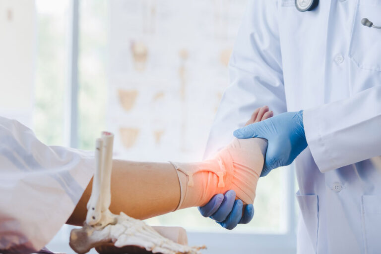 Foot & Ankle Fractures: When Surgery Is Necessary for Proper Healing